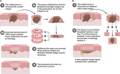 Frontiers Paired Agent Imaging As A Rapid En Face Margin Screening